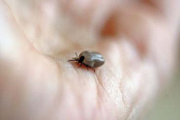 How to remove a tick